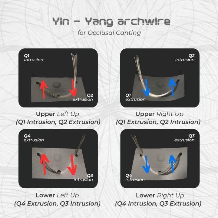 Yin Yang Wire (TMA) - 1825 Lower 60 degree (Sold per unit)